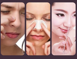 Transform Your Skincare Routine with the Visual Blackhead Acne Remover
